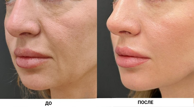 Результат до и после 7