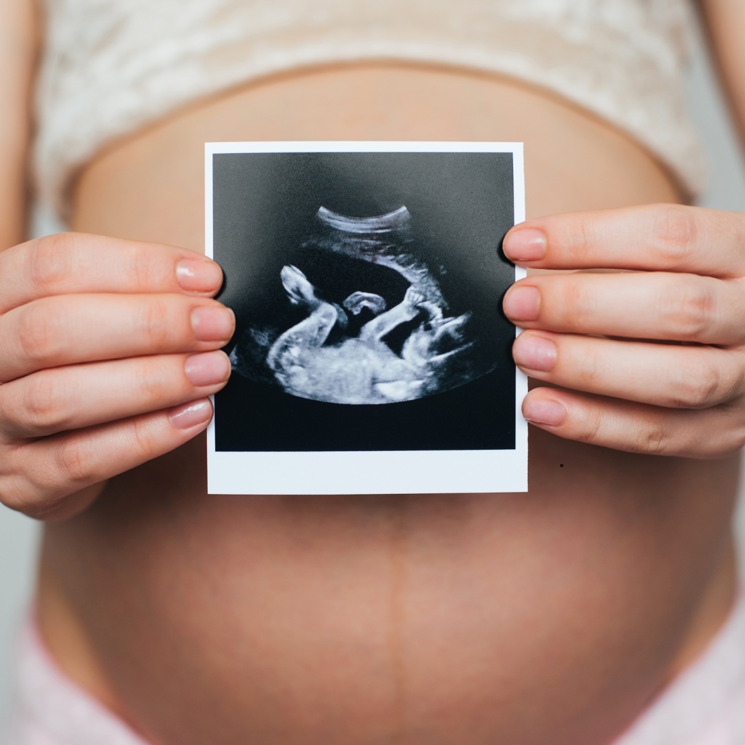 Будущая мама