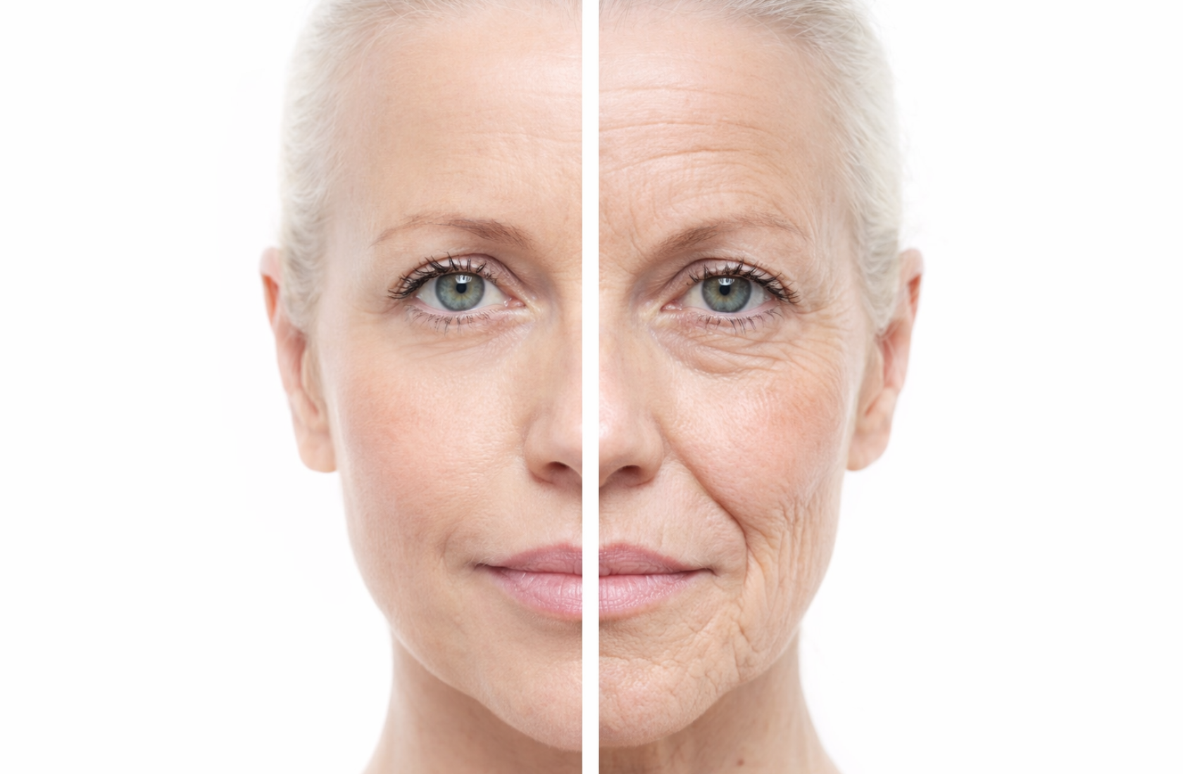 Обвисшая кожа