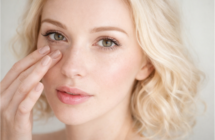 Темные круги и синяки под глазами