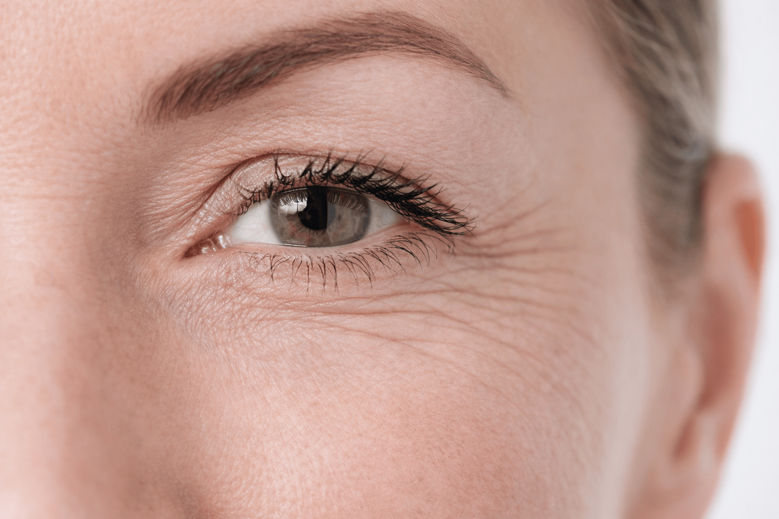 Морщины под глазами – причины, виды и эффективные методы коррекции