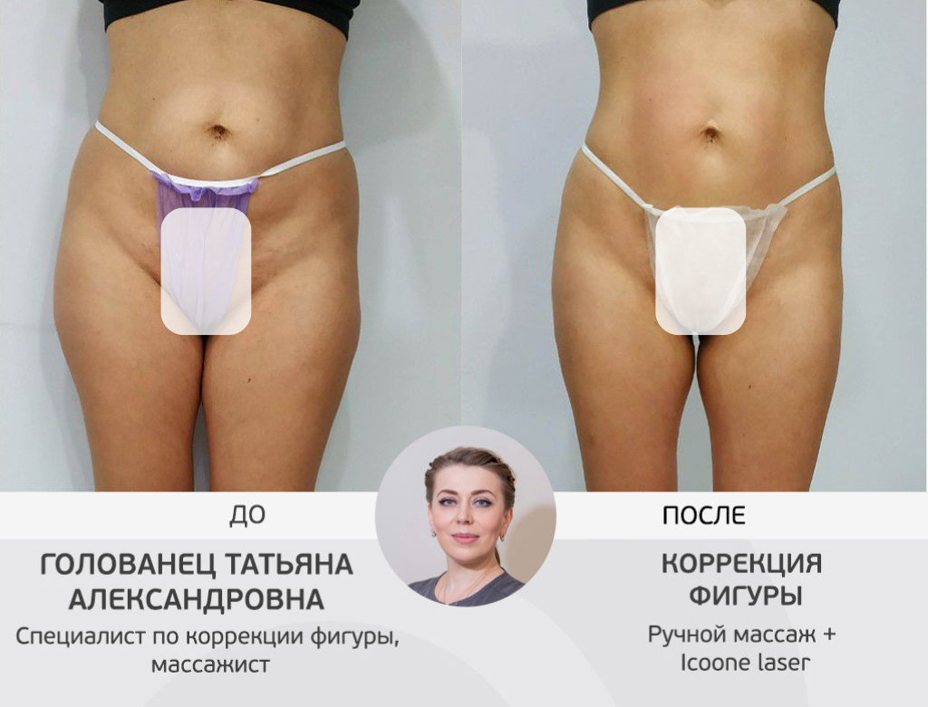 услуги Ручной массаж тела - фото №4