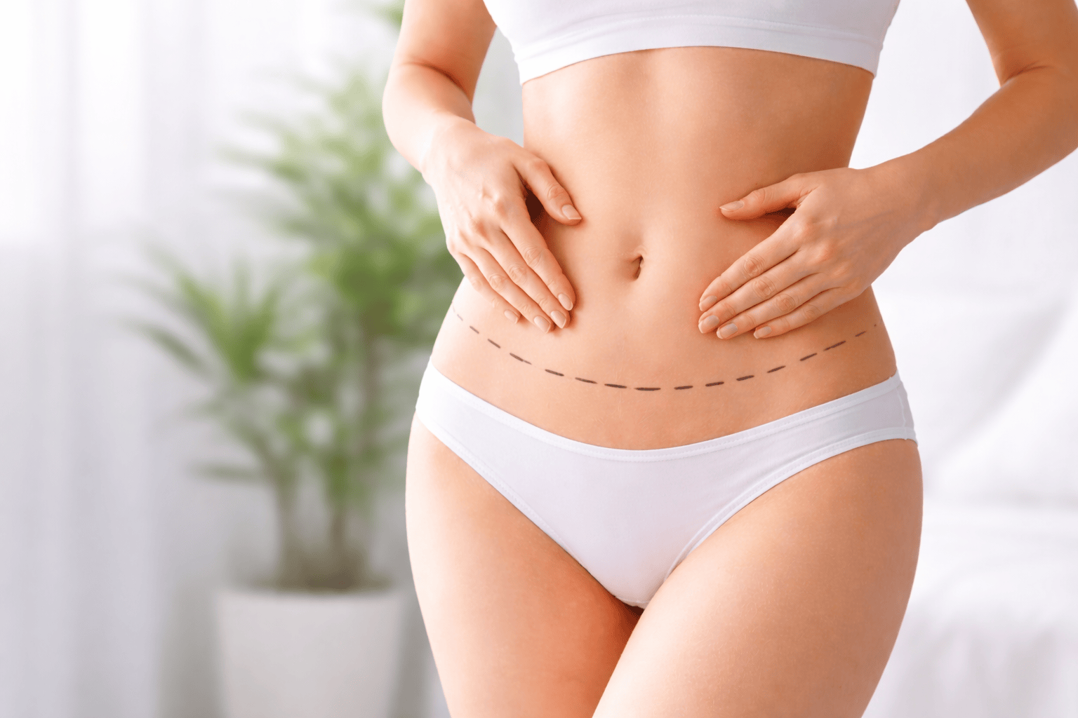 Абдоминопластика: подтяжка живота, виды операции и восстановление 