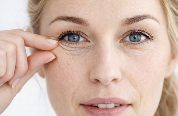 Как убрать морщины под глазами
